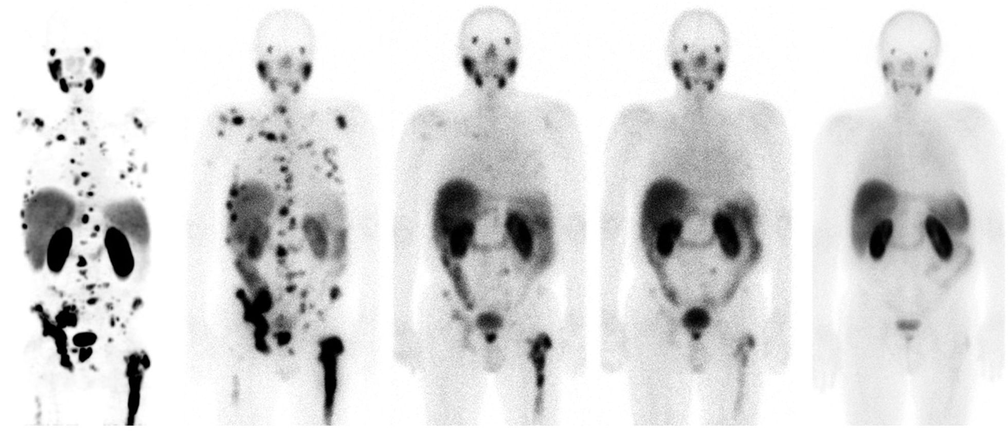 Teragnosis: una nueva esperanza contra el cáncer